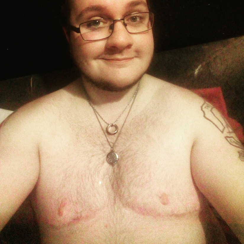 Photo of Kai two years and two days post top surgery. Photo of Kai with glasses on, shirtless, with scar lines. 